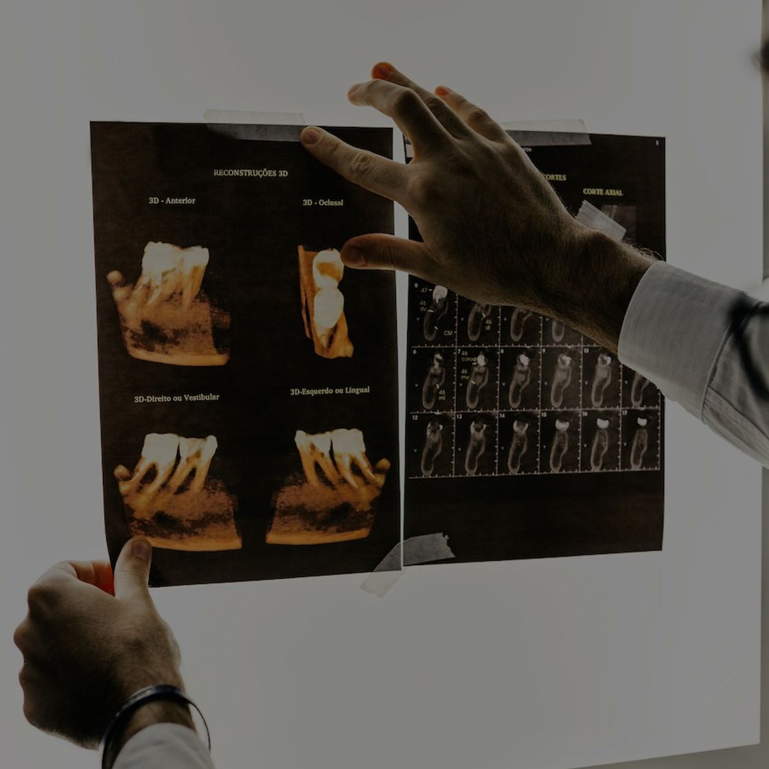 A close up on a dental imaging screen showing the roots of molars and other teeth.