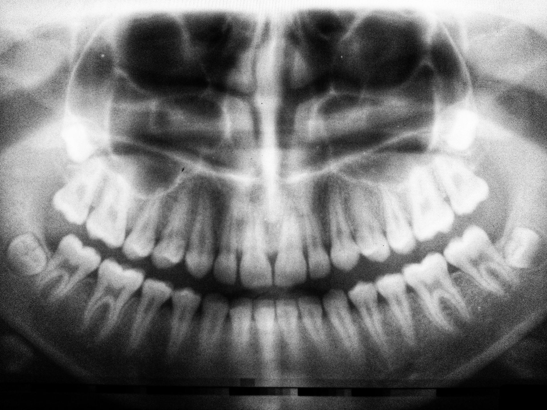 A full face radiograph of teeth used in a dental website design
